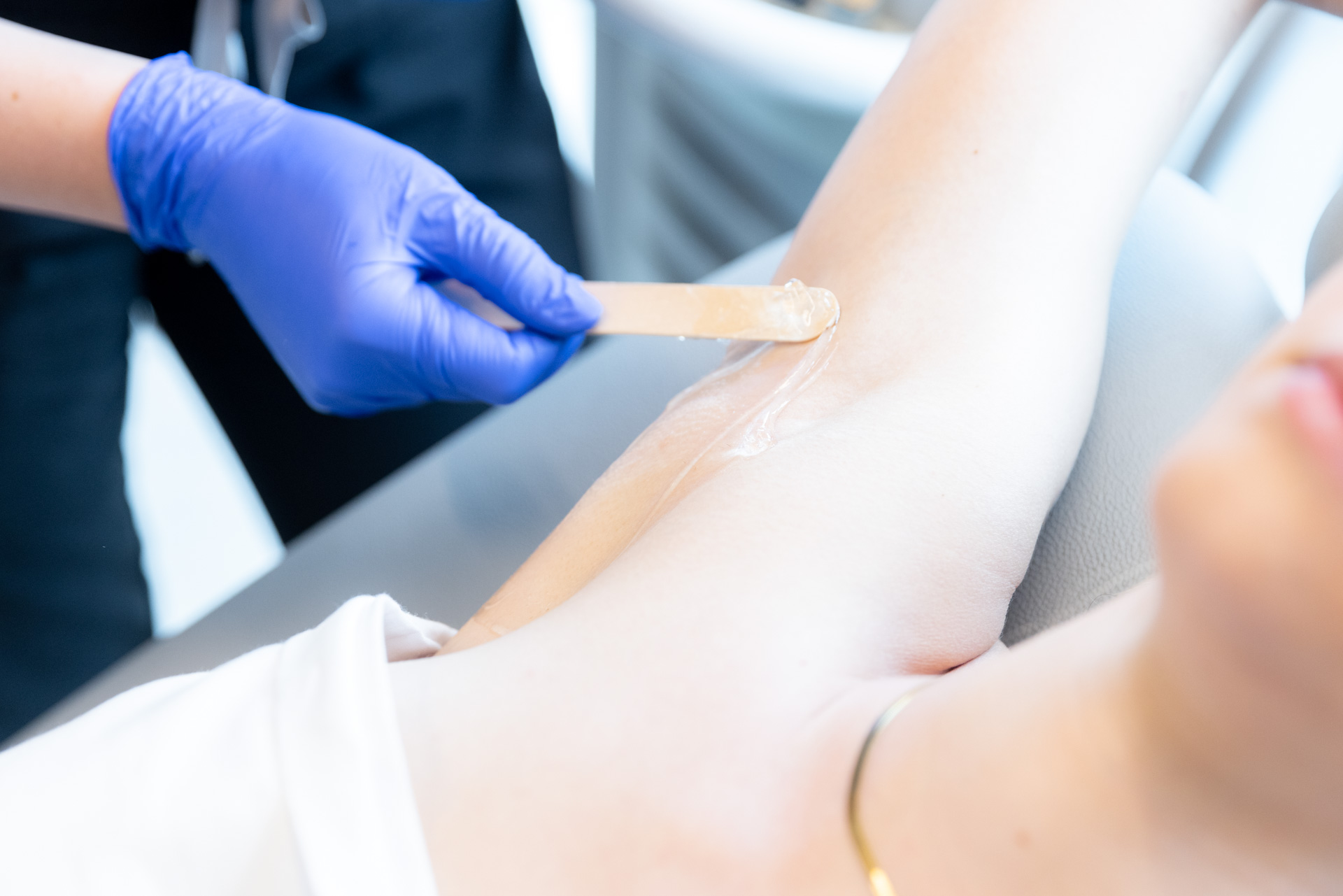 Laser Hair Reduction solution application to patient's armpit