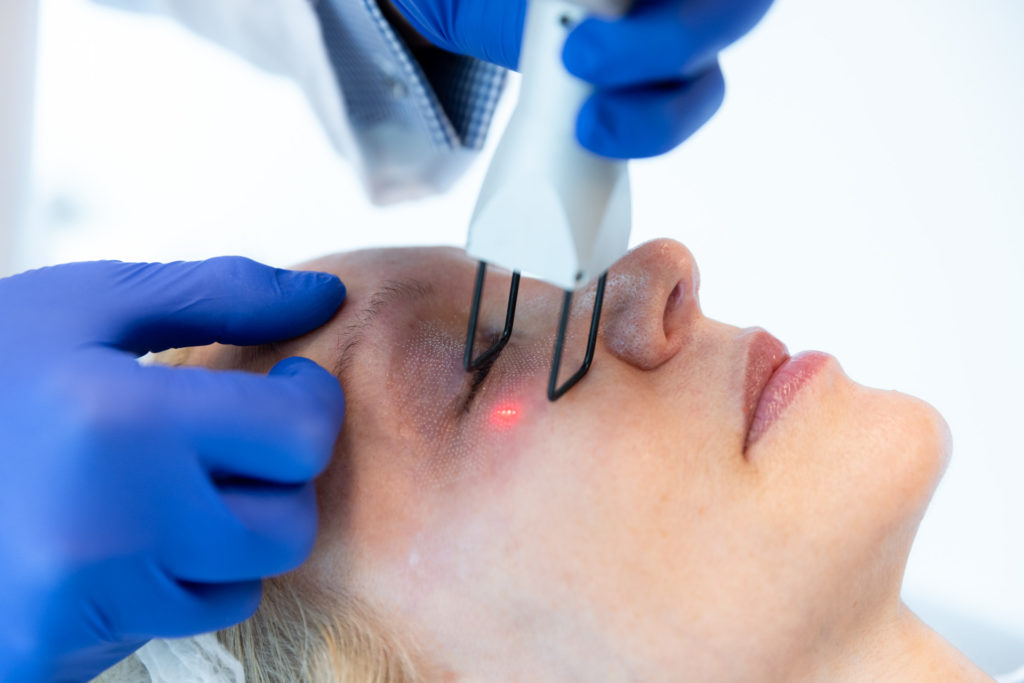 Dr. Pearlman using laser on patient's face