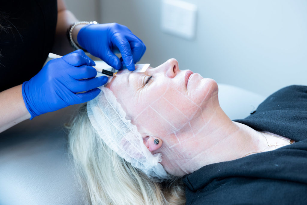 Specialist marking patient's face for ultherapy