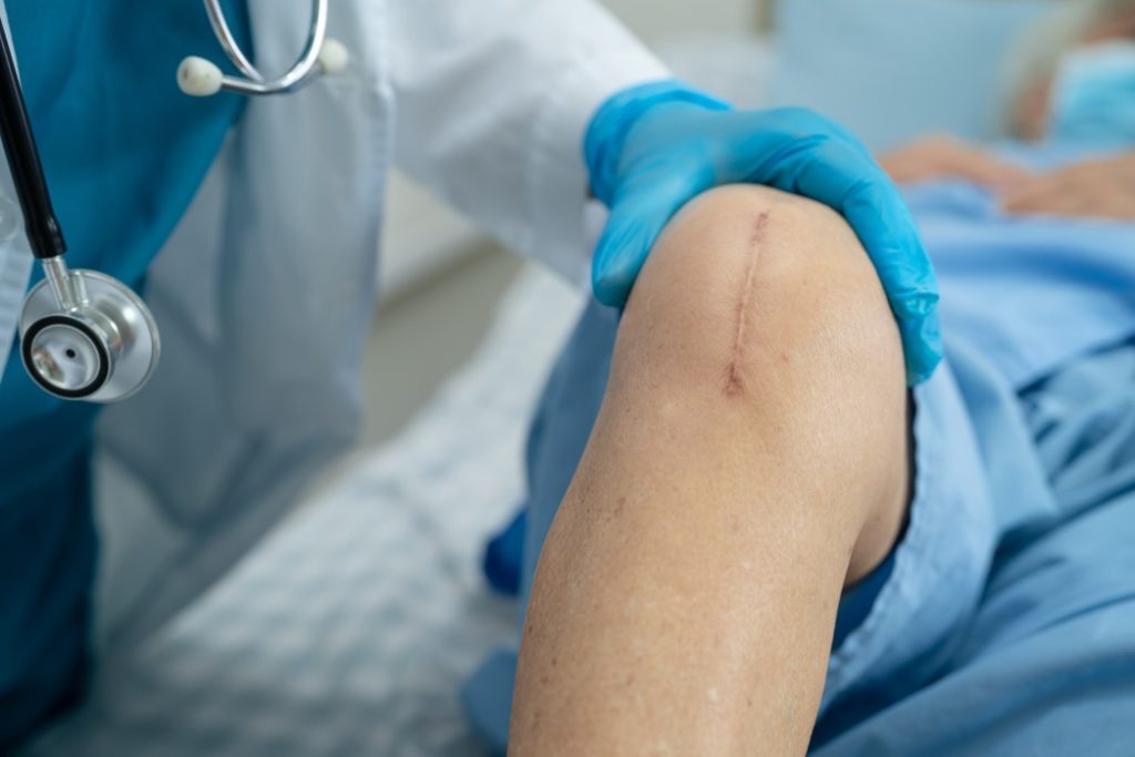 doctor examining patient's scar on knee